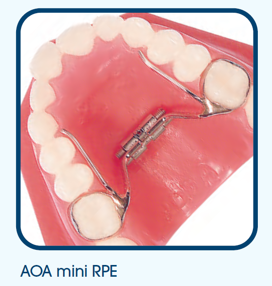 palatal expander model